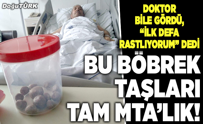 Bu böbrek taşları tam MTA’lık!