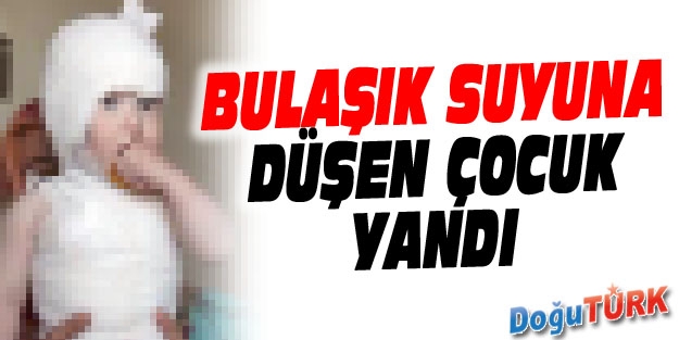 BULAŞIK LEĞENİNDEKİ SICAK SUYA DÜŞEN ÇOCUK YANDI