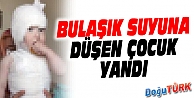 BULAŞIK LEĞENİNDEKİ SICAK SUYA DÜŞEN ÇOCUK YANDI